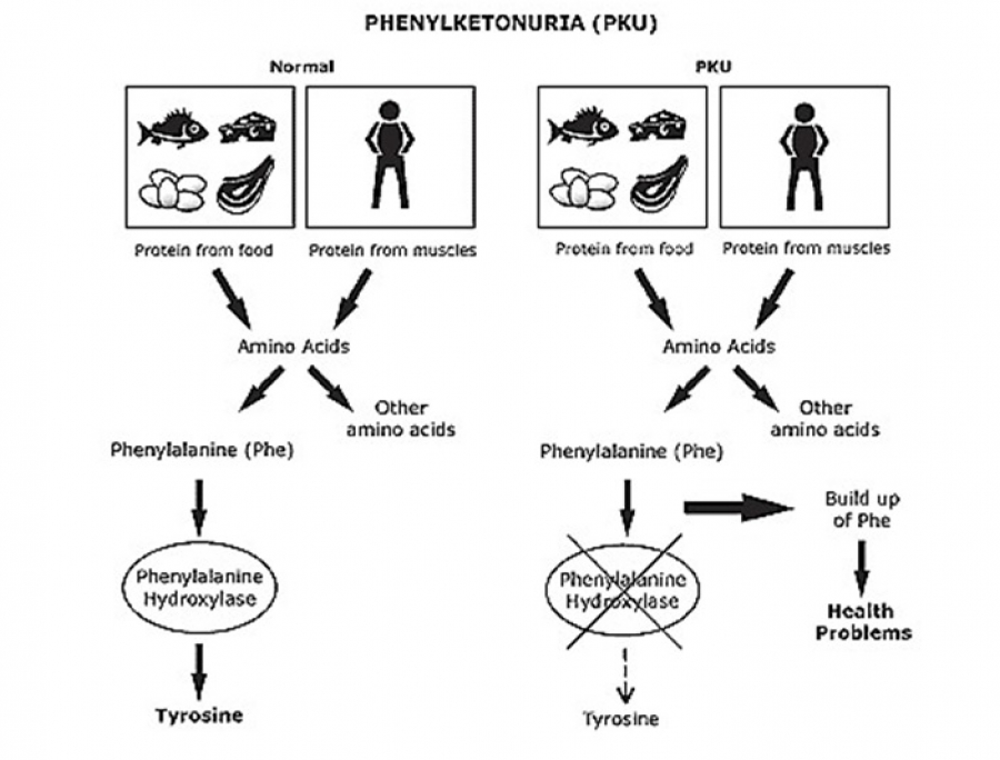 PHNEYLKETONURIA